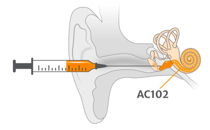 Onderzoek acuut gehoorverlies